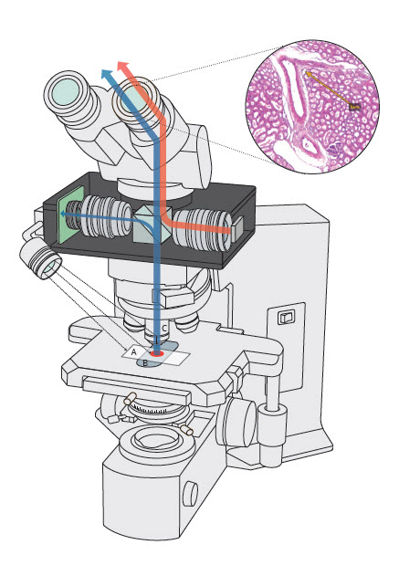 AR microscope for pathology artificial intelligence
