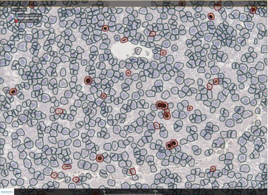 cell density analysis freehand line